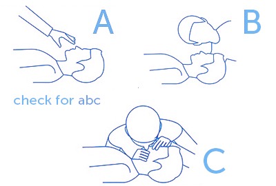 3 Check for ABC